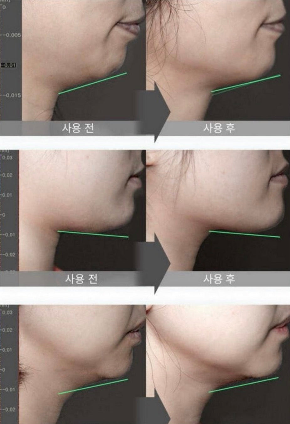 Bravity Effectra Medic Shaper 100ml